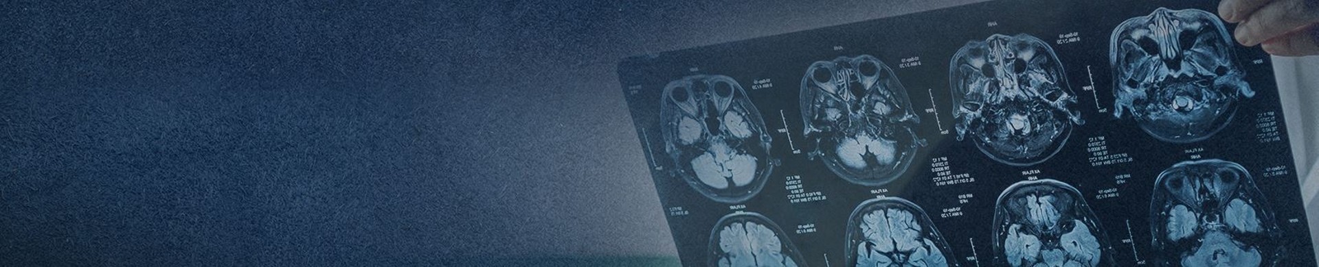 Pasadena Traumatic Brain Injury lawyer